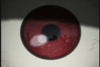 Eyeball